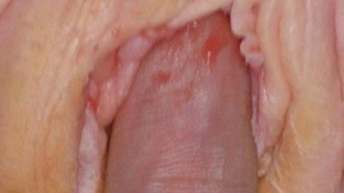 e nebunie curata in aceasta tara de cand a aparut poza asta oamenii stau la cozi kilometrice