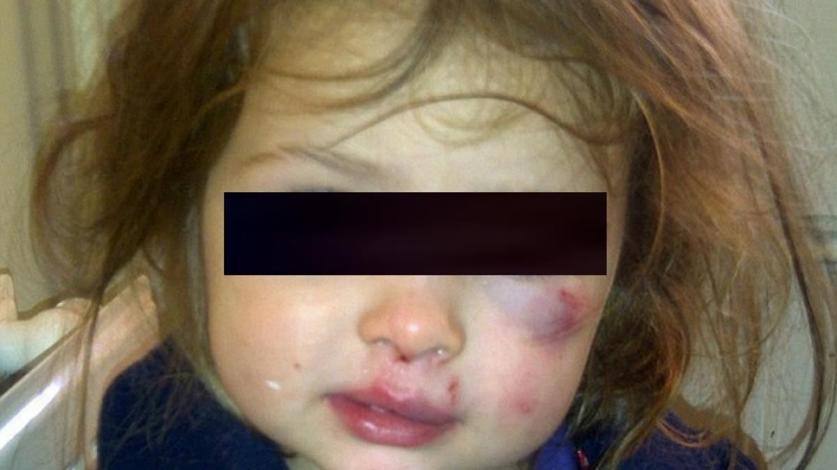 bataie pe paine 63 dintre copii batuti de parinti nuiaua cureaua si lingura de lemn cele mai