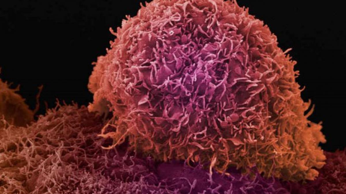 testul care ar putea salva milioane de vieti va ajunge pe piata britanica in cel mult 5 ani