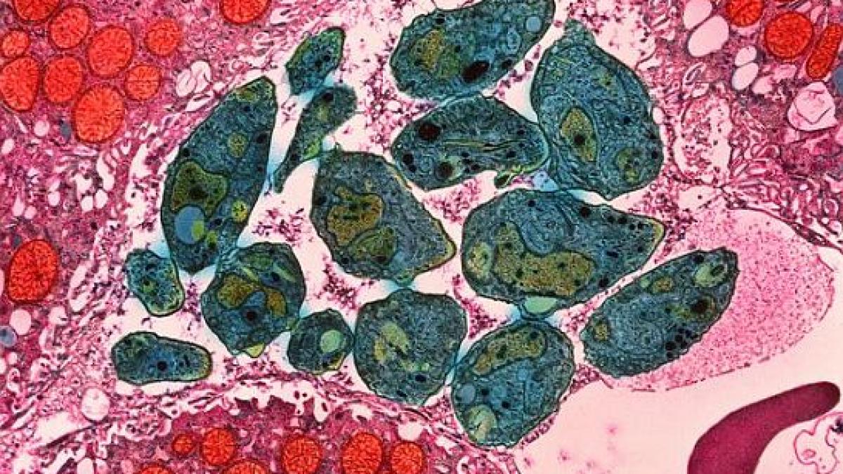 40 din oamenii de pe terra au acesti paraziti in creier iti schimba comportamentul nu mai esti tu