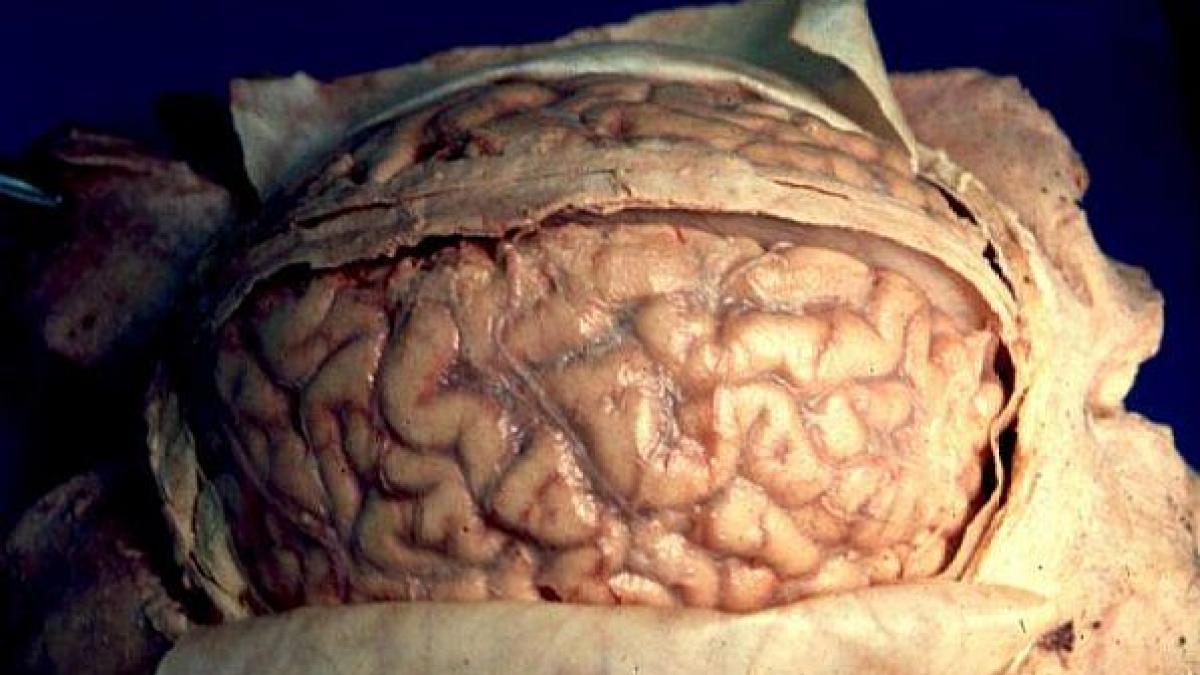 proiectul de 1 milion de dolari finantat de americani care intra in mintea noastra