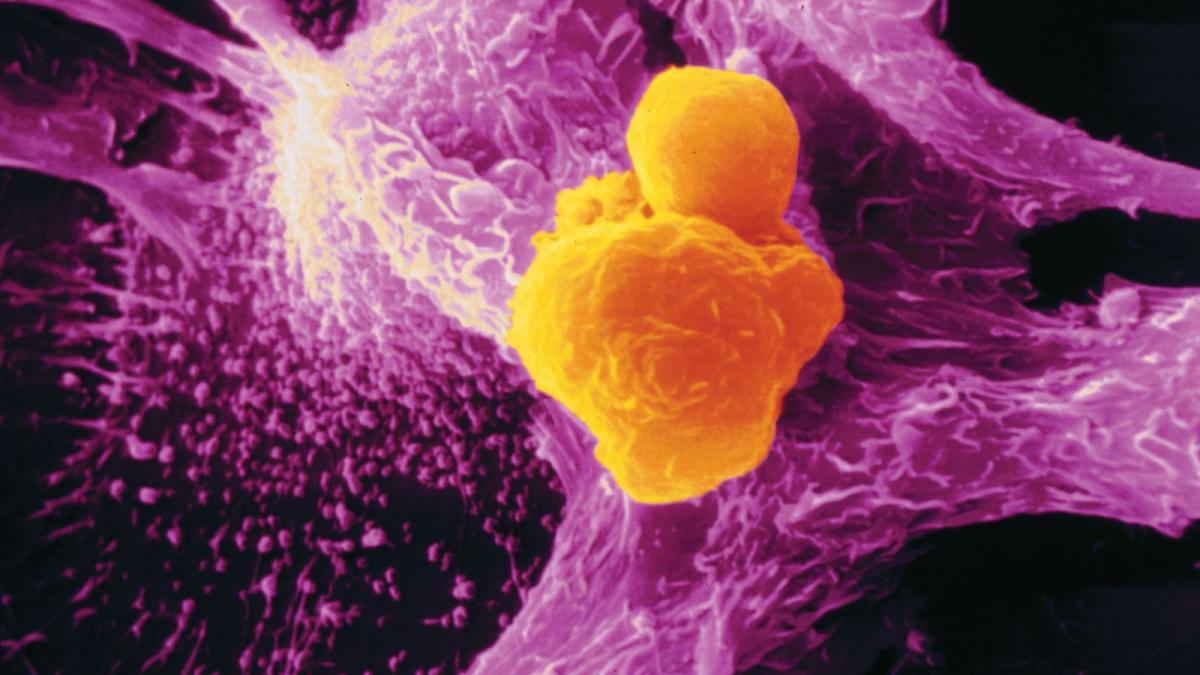 terapia care aduce speranta bolnavilor de cancer oamenii de stiinta sustin ca au descoperit cum sa