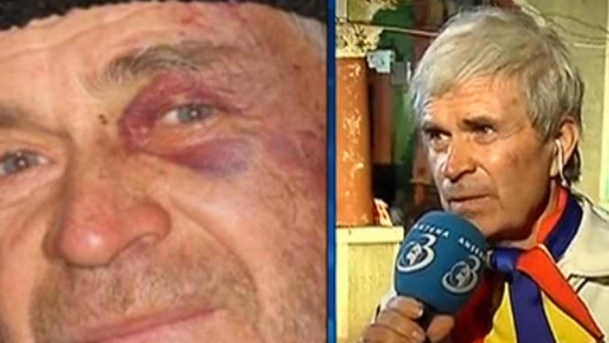 batranul care a fost batut in timpul protestelor din piata universitatii am strigat cat am putut