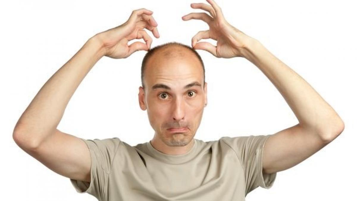 daca esti posesorul unei chelii remarcabile scapa de ea prin metoda vampirului