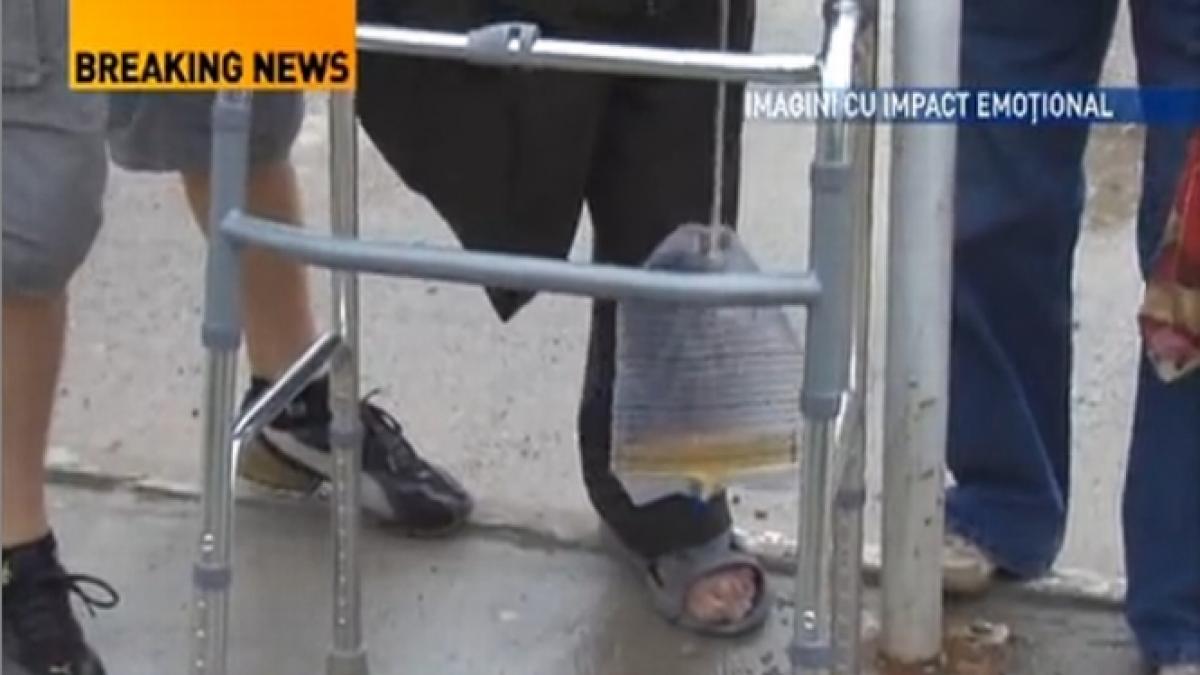 cu piciorul amputat chemat la evaluare starea barbatului se putea imbunatati sustine directia de