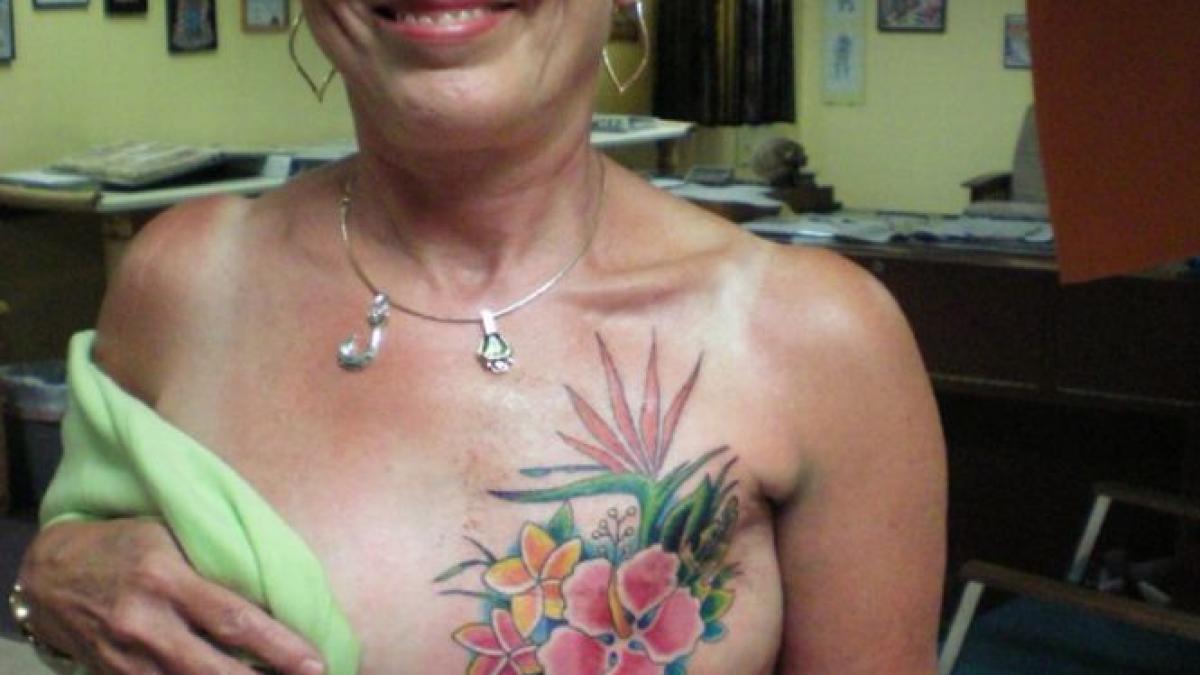 masura radicala pe care trebuie sa o ia femeile cu risc crescut de cancer ce este mutatia brca