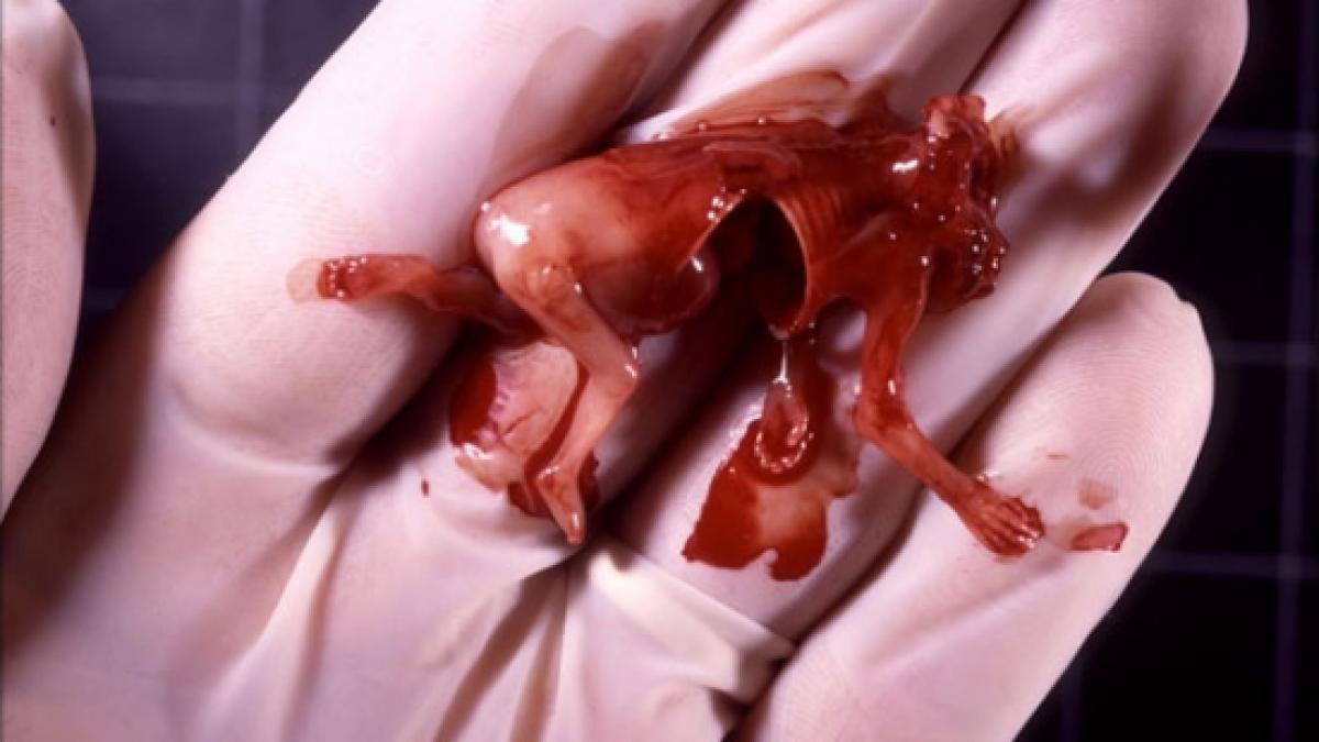 un medic american care efectua avorturi a fost gasit vinovat de crima