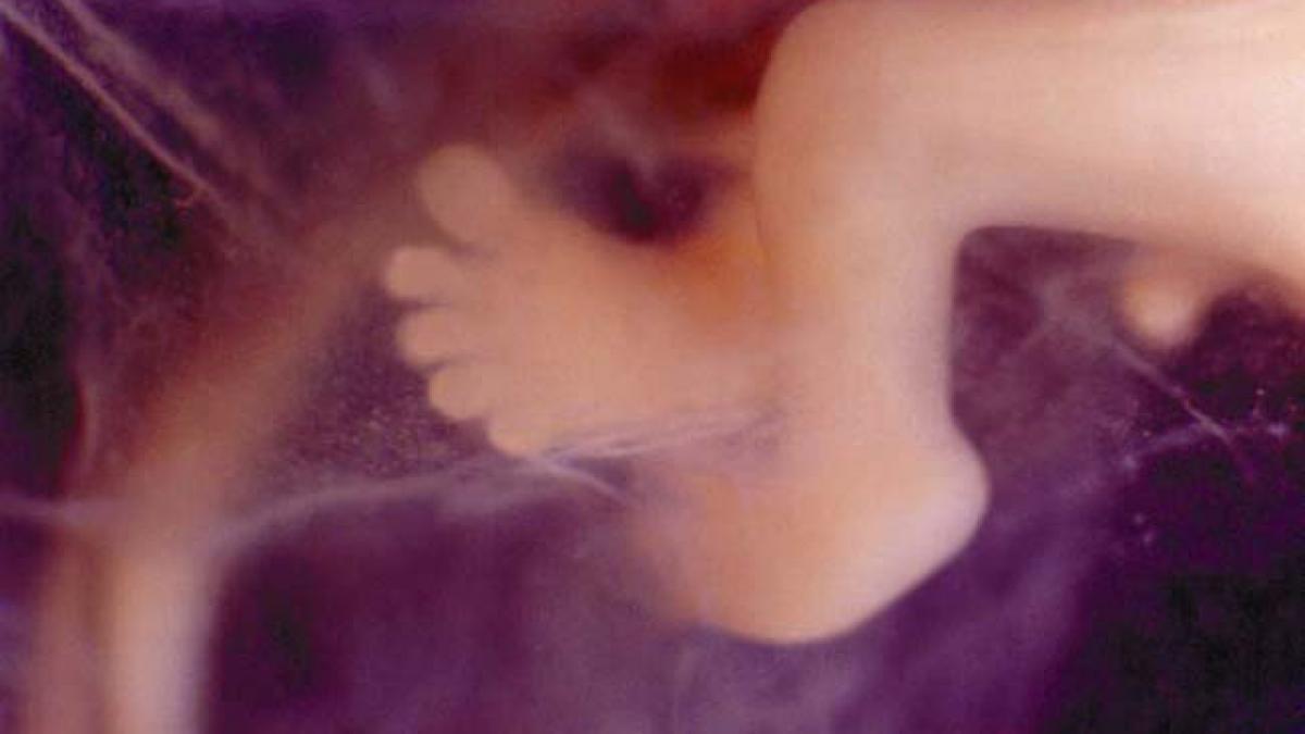 statistici ingrijoratoare despre tinerele din romania 10 000 de adolescente au ales sa faca avort