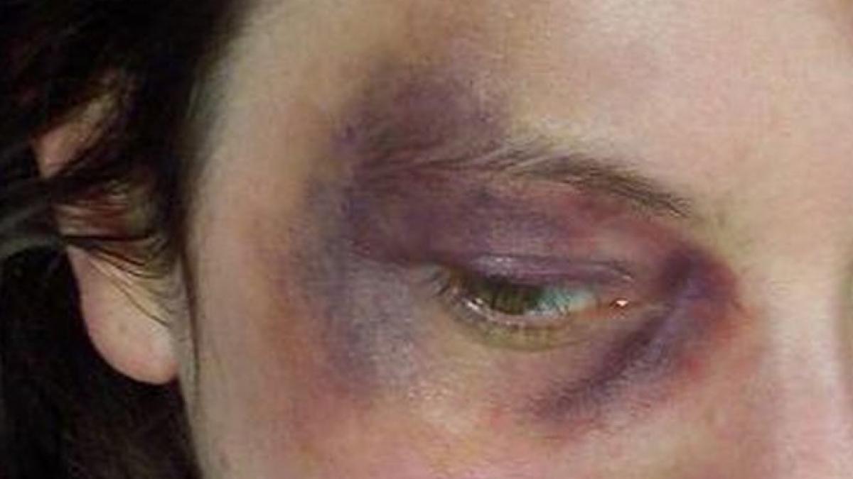 dramele din spatele unor vieti aparent stralucitoare vedetele autohtone victime ale barbatilor care