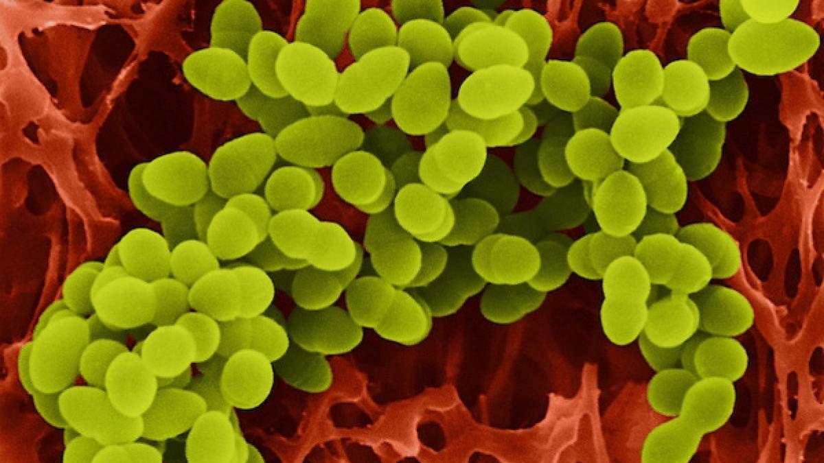 stafilococul auriu cauza toxiinfectiilor alimentare cu repetitie de la satu mare