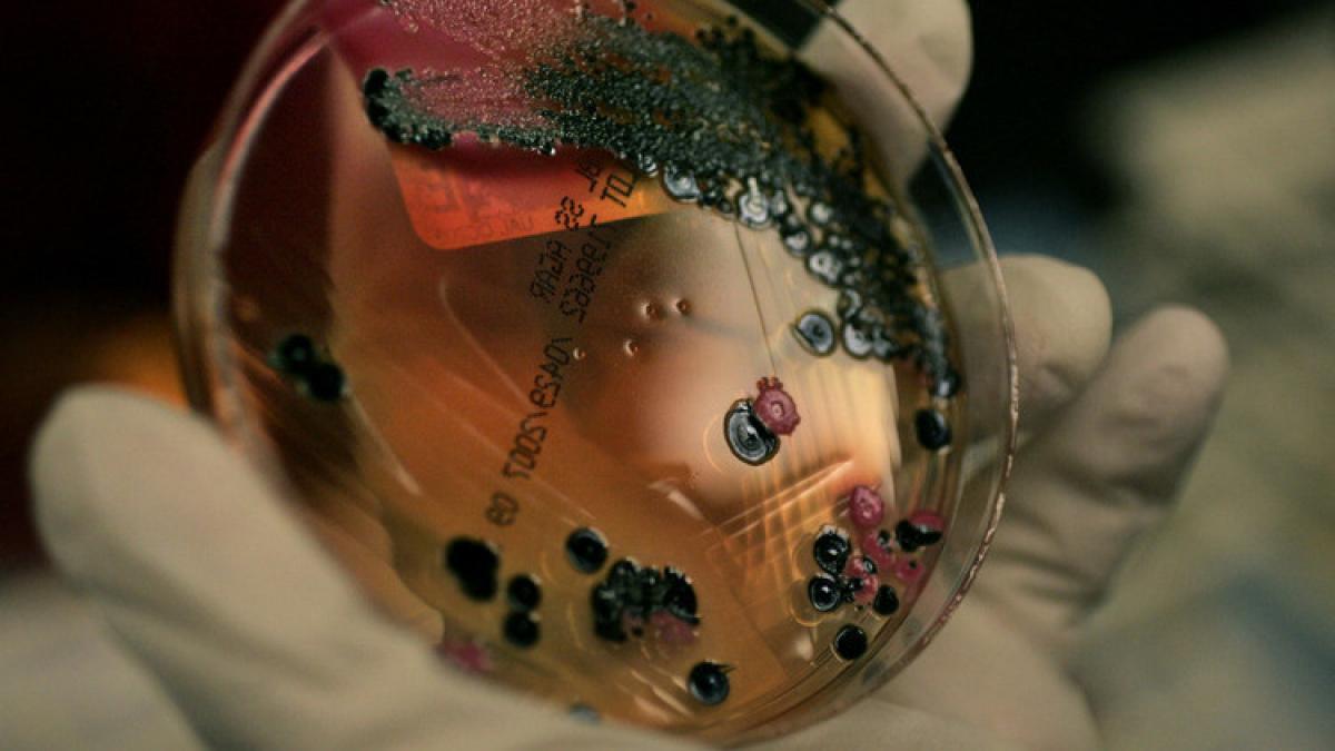 carne de curcan cu salmonella depistata in magazine din botosani si bacau