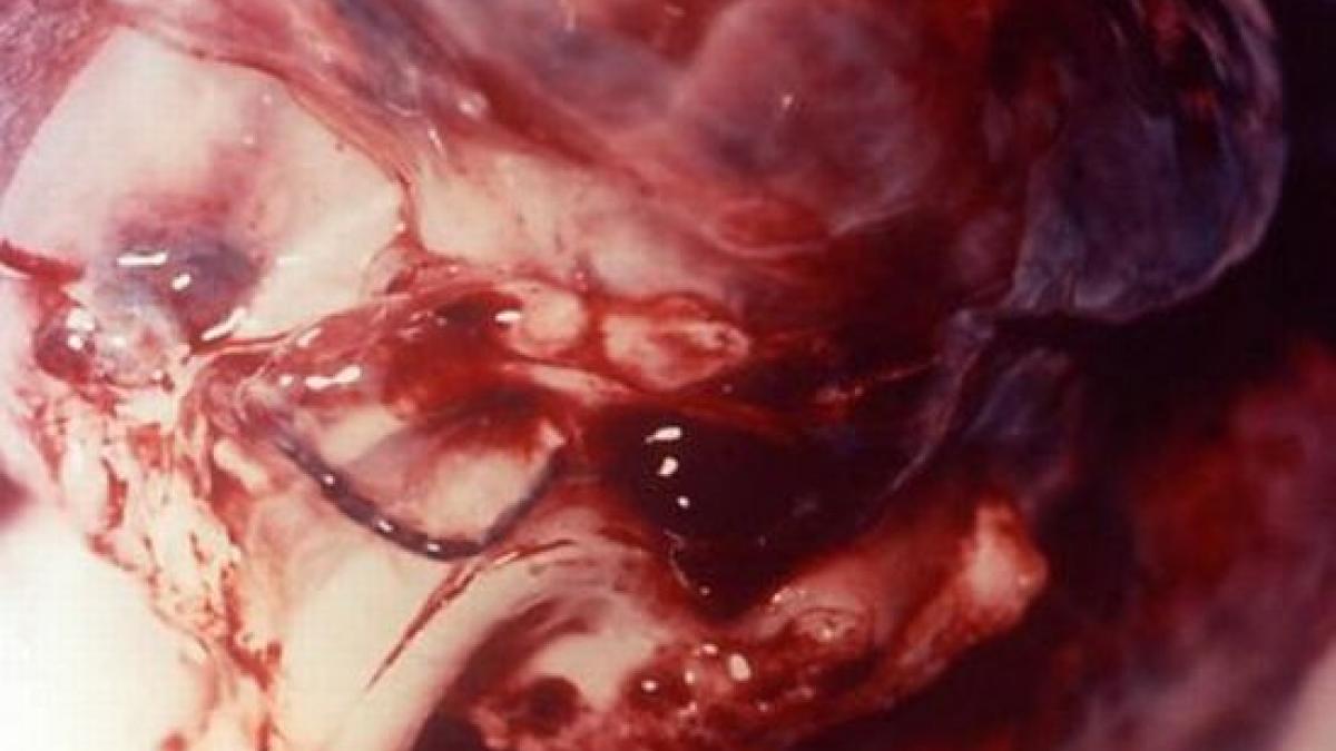 focar de antrax in republica moldova in apropiere de granita cu tara noastra patru oameni au ajuns