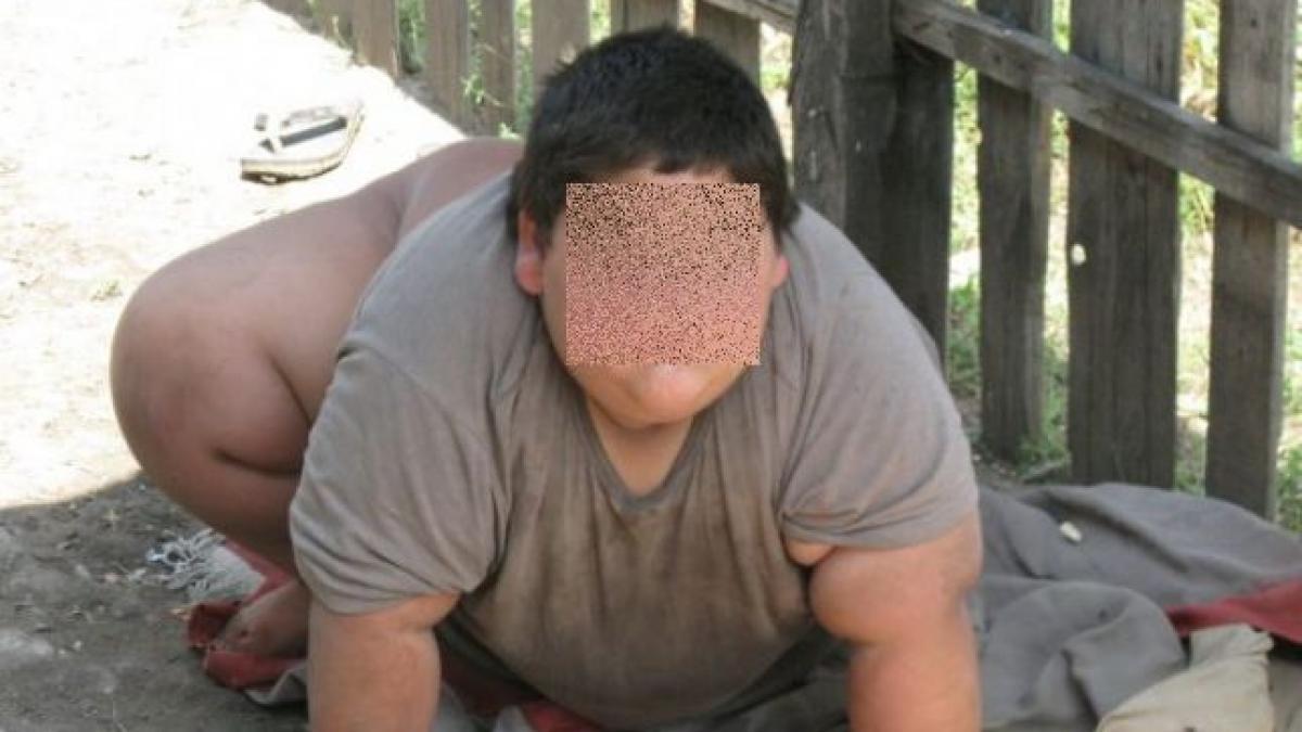 caz socant de obezitate morbida in romania la varsta de 6 ani cantareste 120 de kg