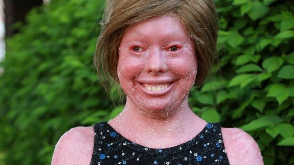 tanara care nu a inchis niciodata ochii copiii ca ea mor la cateva zile dupa nastere ea e o minune