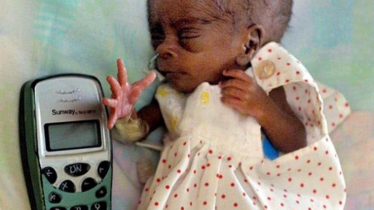 miracolul vietii la nastere medicii i au dat 1 sanse de supravietuire era putin mai mare decat un