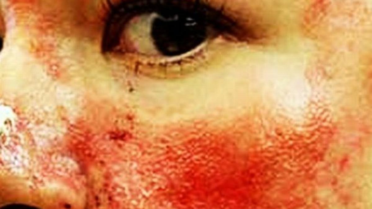 britanice mutilate in tanzania doua tinere de 18 ani atacate cu acid