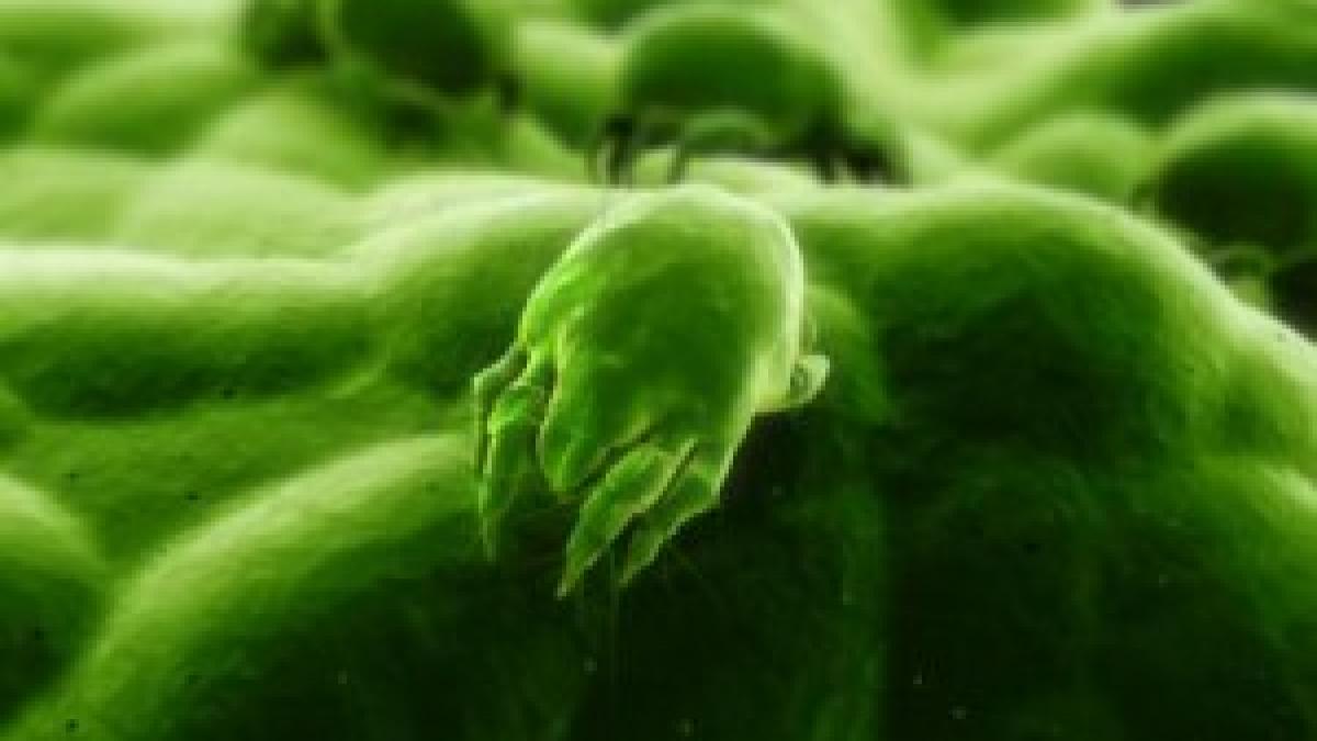 dusmanii din perne ce boli poti face atunci cand dormi si cum sa le previi