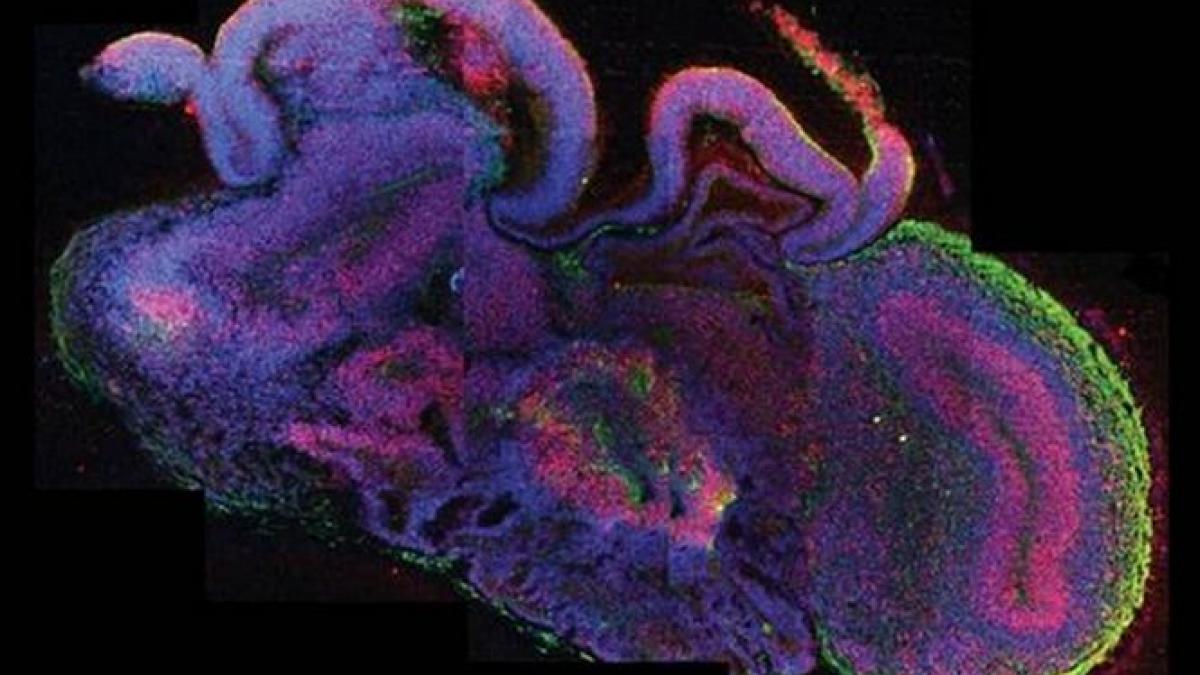 primul creier uman in miniatura dezvoltat in laborator de cercetatorii din austria