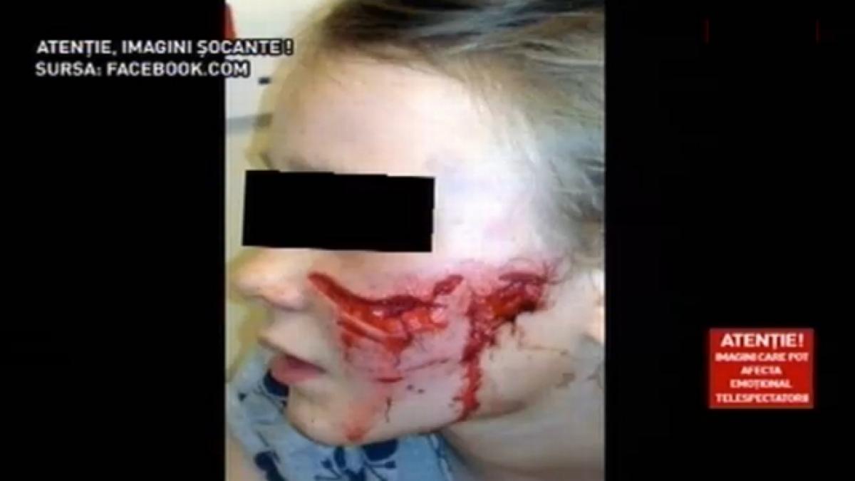 imagini socante oameni muscati de caini maidanezi