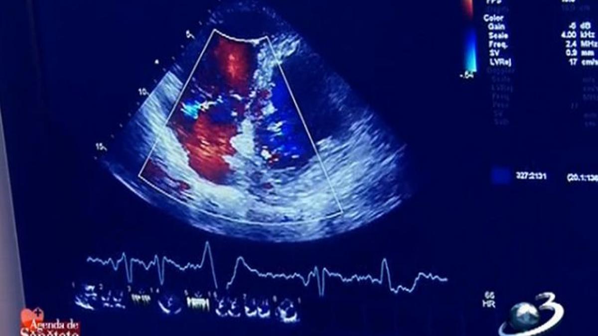 agenda de sanatate hipertensiunea arteriala ar putea deveni boala secolului
