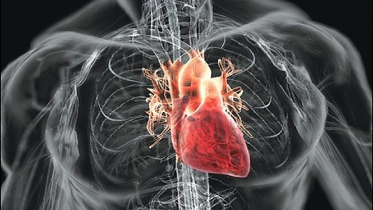 bolile cardiovasculare ii omoara pe romani mai mult decat cancerul la fiecare 30 de secunde un