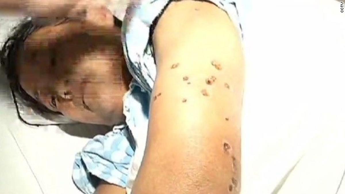 roiuri de viespi uriase au provocat moartea a 42 de persoane si ranirea altor 1 675 in china