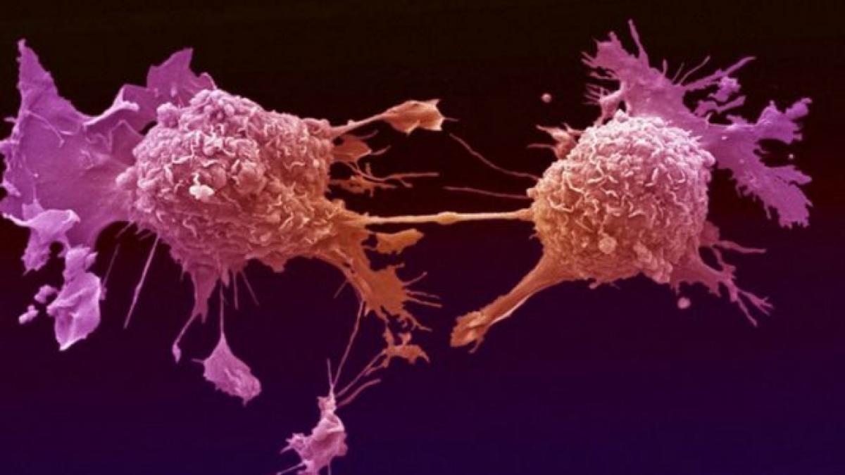 numarul deceselor provocate de cancer in romania s a dublat in numai trei ani