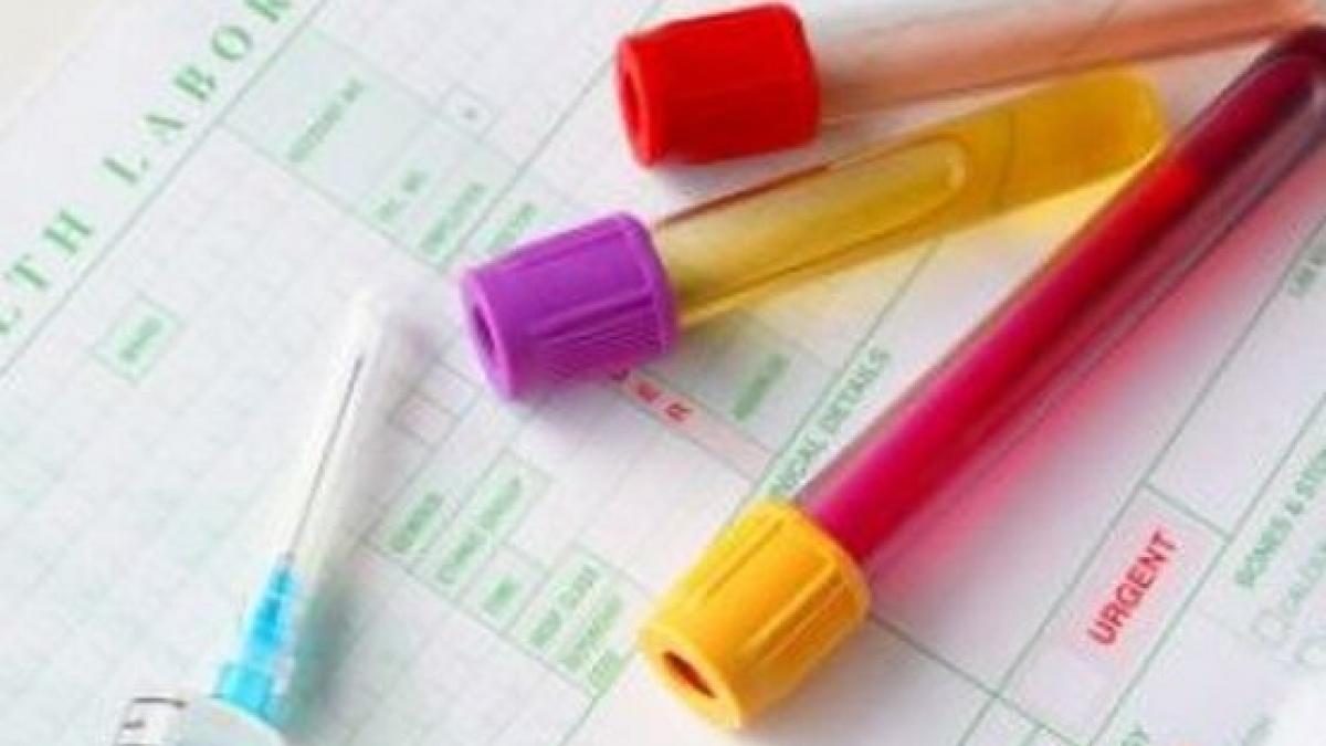 testul de sange care depisteaza gradul de raspandire a cancerului de piele