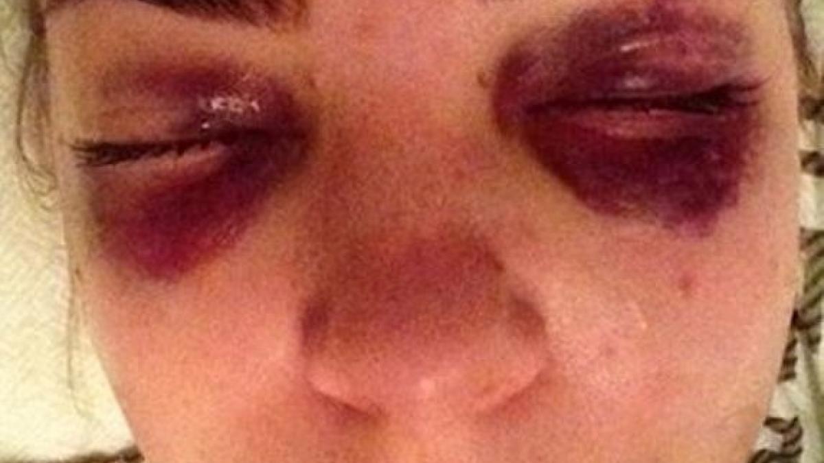 asa arata aceasta fata dupa ce a mers cu trenul m au lovit cu salbaticie