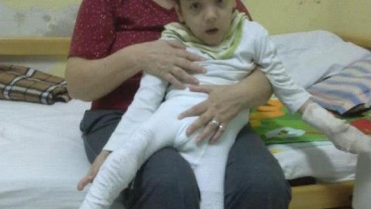 peste 72 000 de copii cu handicap la nivel national aproape jumatate au handicap grav