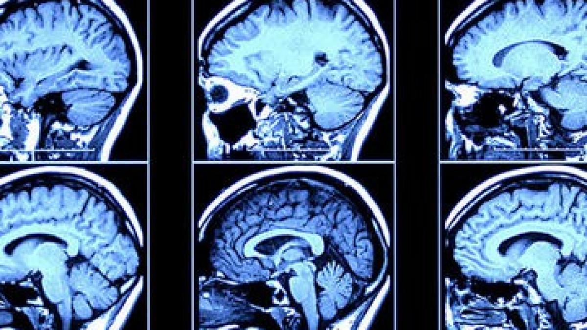 ce a descoperit un medic neurolog cand s a uitat pe rmn ul sau viata lui s a schimbat radical