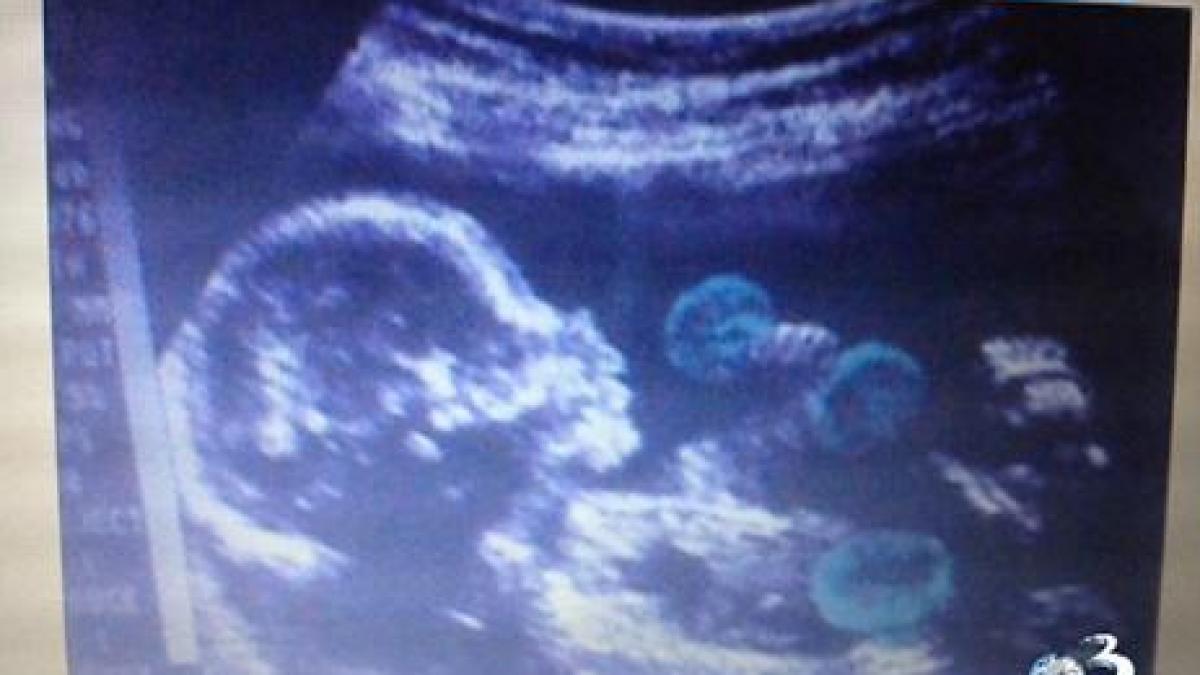 premiera mondiala mircea badea arata prima fotografie cu fiul sau