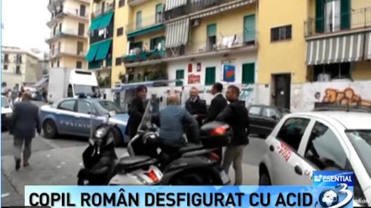 romanca si copilul sau atacati cu acid in italia micutul a fost desfigurat de o italianca