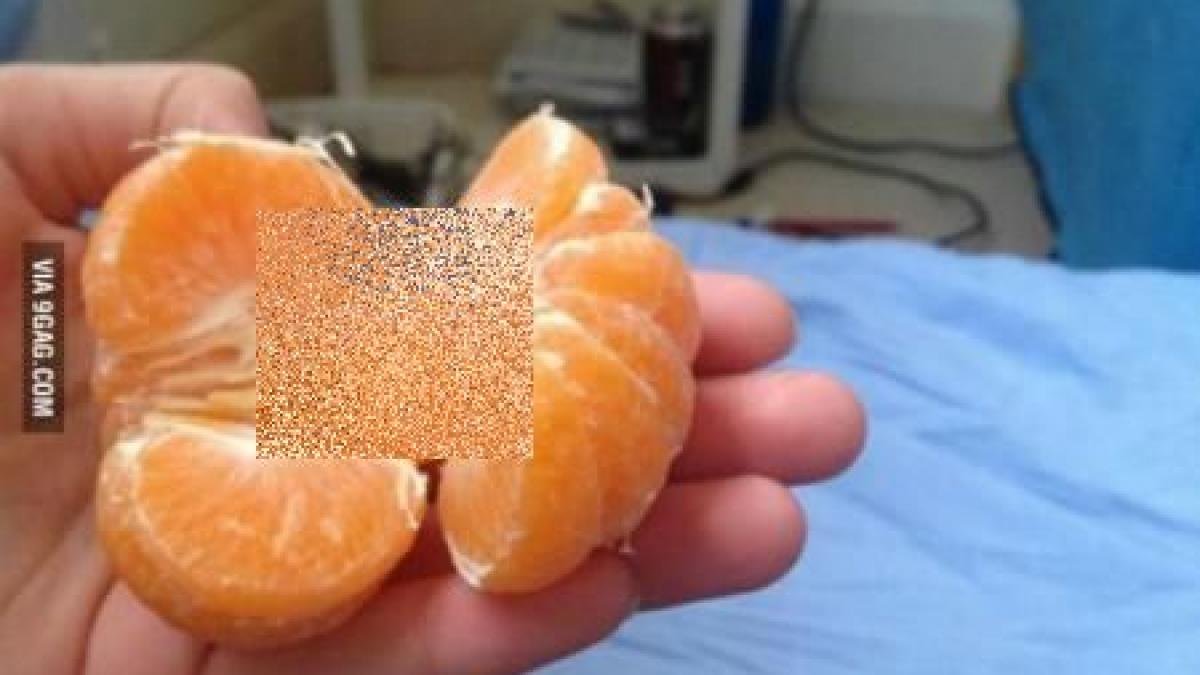 ce a descoperit in interiorul portocalei pe care o decojise cineva a fost insarcinata