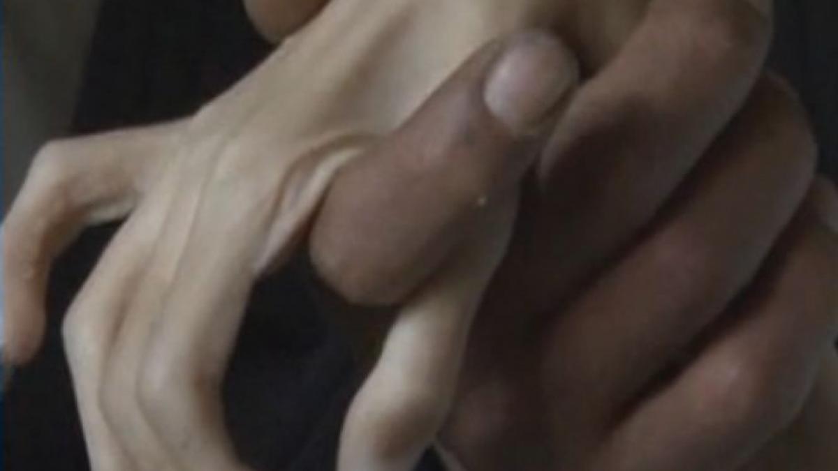 imagini socante are 18 ani cantareste 16 kilograme si este ignorat de autoritati