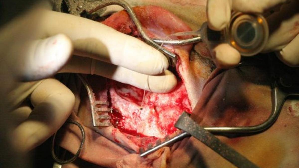 am batut germania un medic chirurg din cluj a inregistrat un nou record