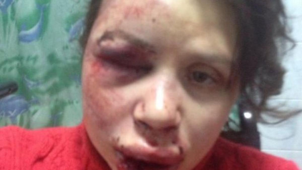 o jurnalista a fost batuta cu salbaticie si aruncata intr un sant acum se afla la terapie intensiva