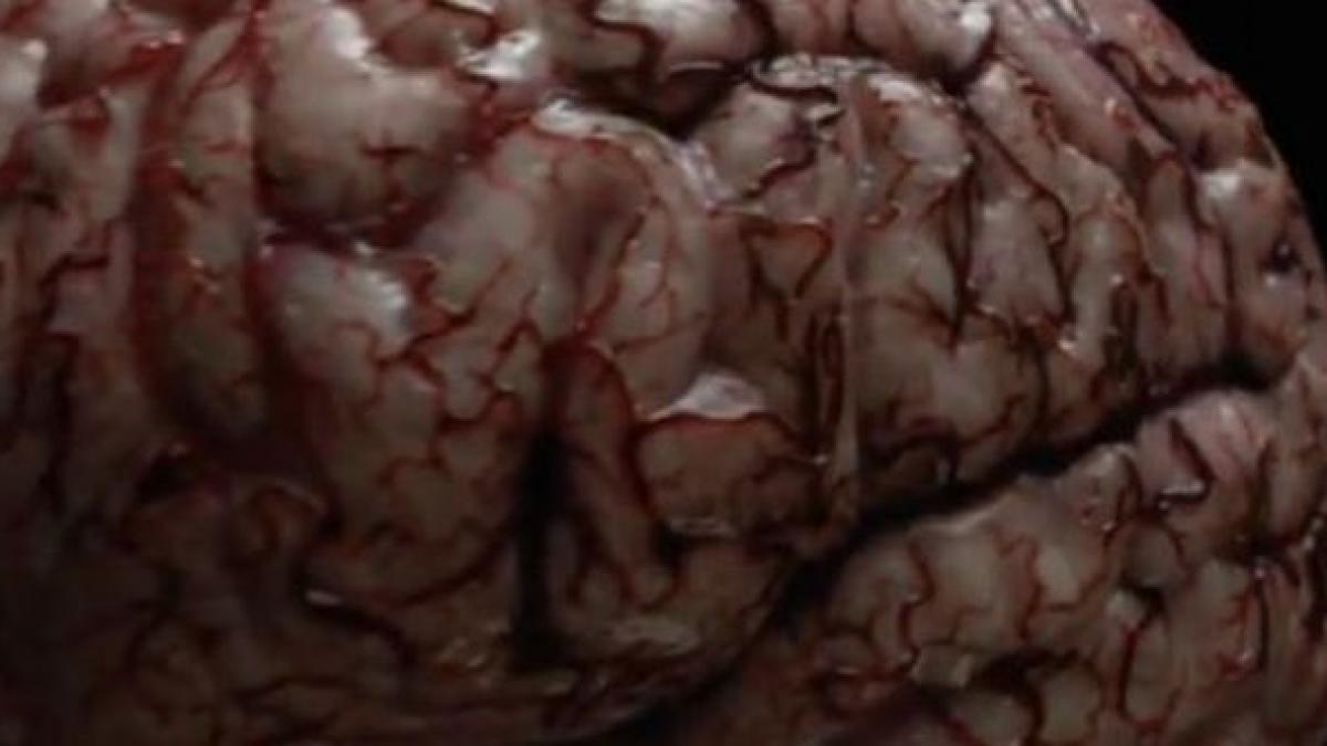 daca vezi asta te ai putea opri din fumat cum arata creierul unui fumator