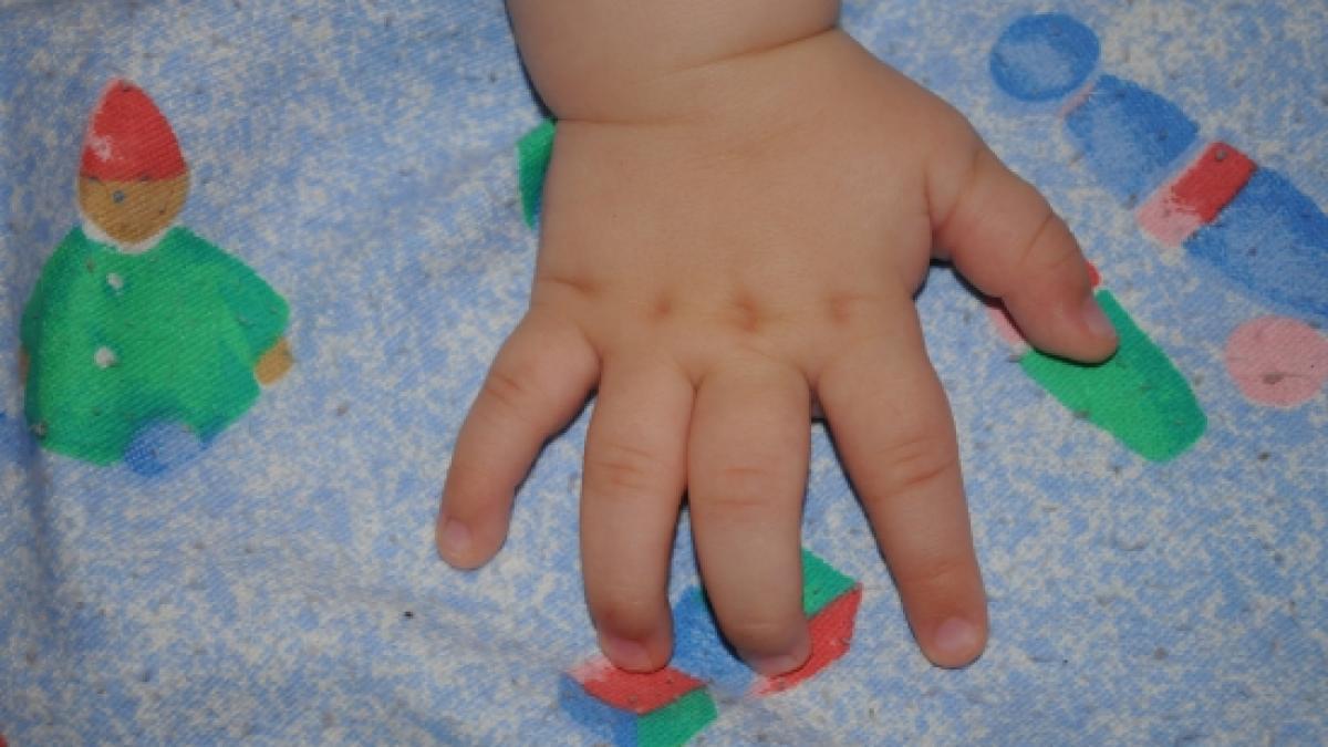 masuri in spitalul judetean bacau sase saloane ale sectiei de pediatrie au fost inchise din cauza