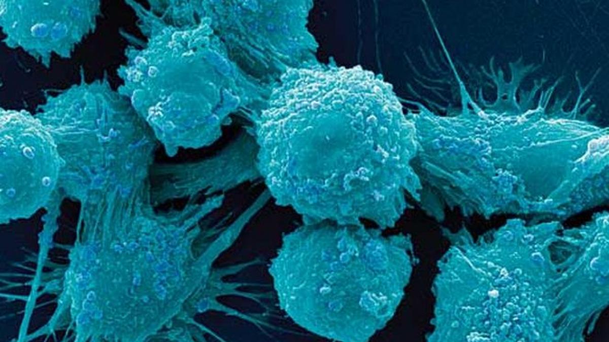 descoperirea revolutionara care ar putea scadea considerabil numarul deceselor provocate de cancer