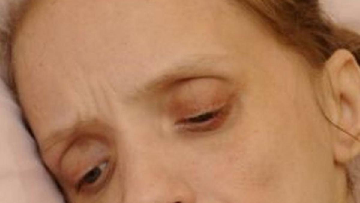 are 35 de ani dar arata de 80 vezi povestea femeii care a baut 40 de beri pe zi timp de 15 ani