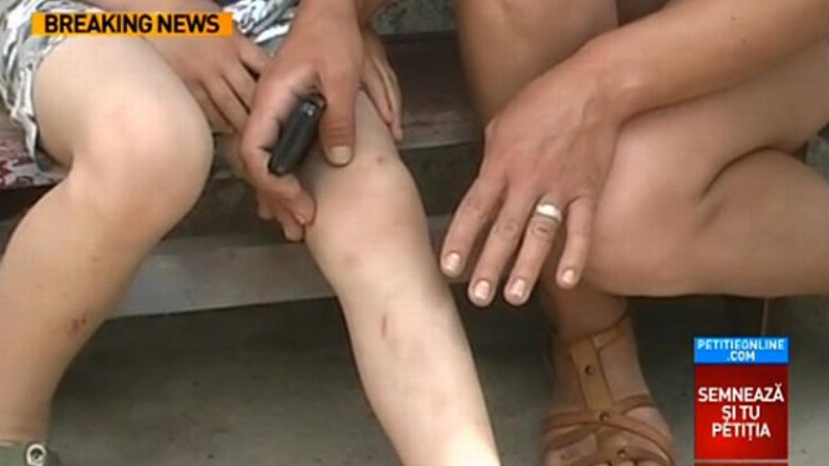 o fetita de 11 ani a fost batuta crunt de propriul tata