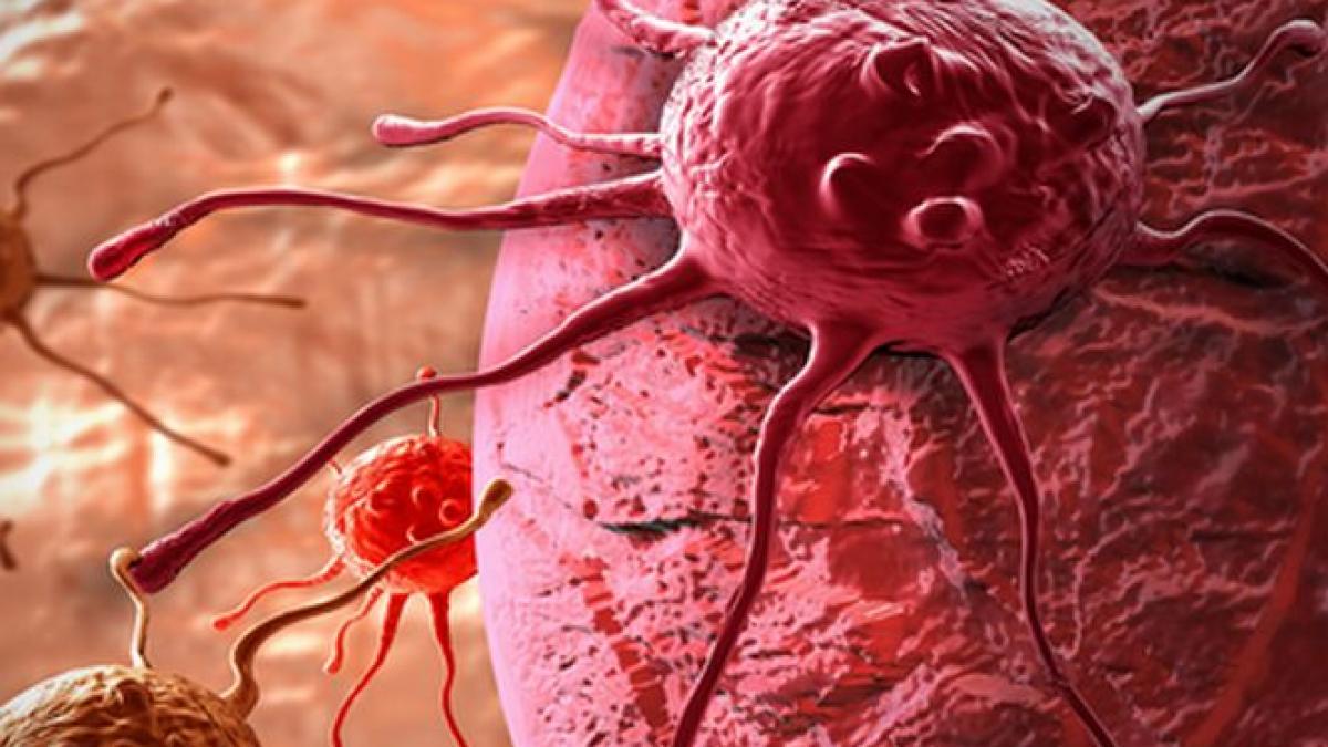 organizatia mondiala a sanatatii un tsunami de cancer va lovi populatia globului in viitorul