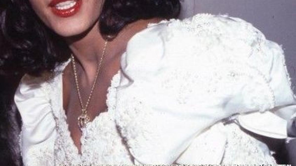 pur si simplu ii cade fata cine este celebra actrita care si a facut 25 de operatii estetice intr o