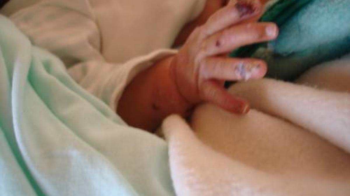 asta se intampla in romania noastra un bebelus a murit din cauza neglijentei criminale a parintilor