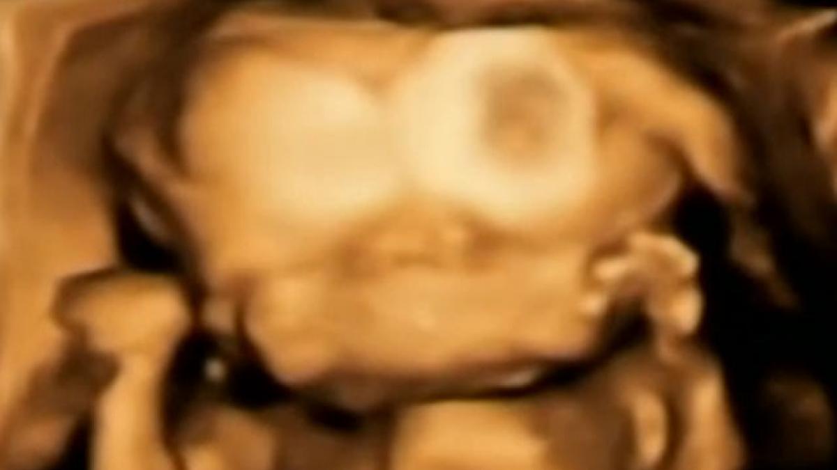 initial medicii i au spus ca va avea gemeni ce are aceasta femeie in burta e o decizie foarte grea