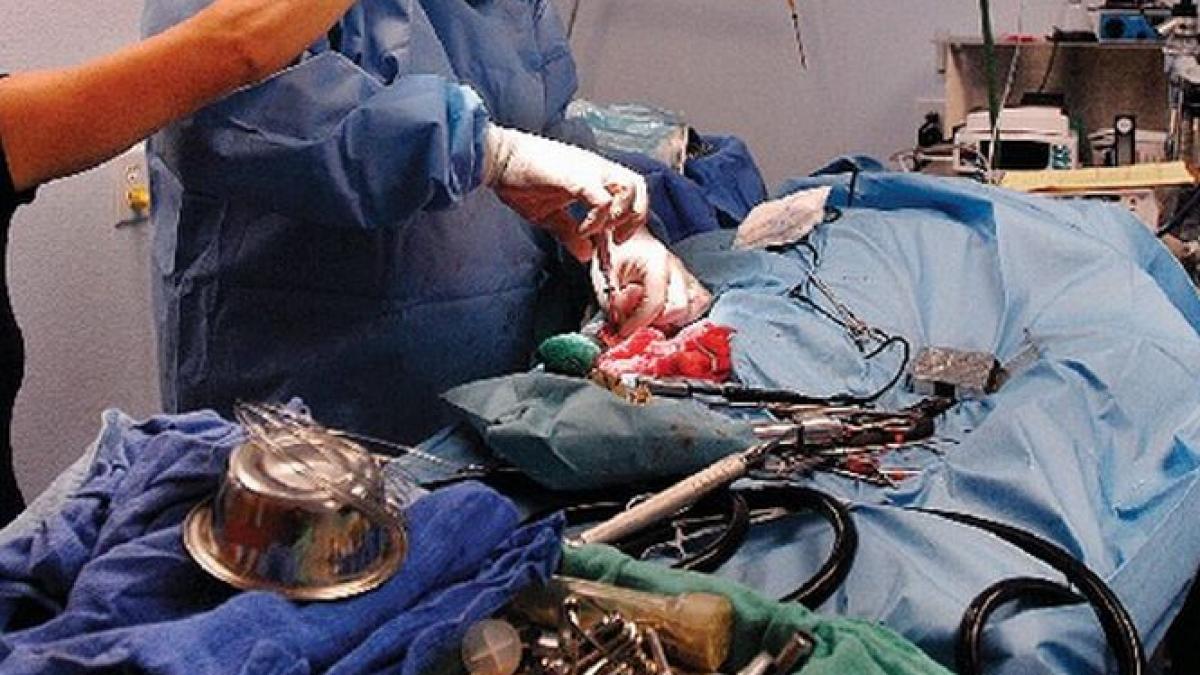 medic acuzat de malpraxis la brasov un copil a fost operat la piciorul sanatos