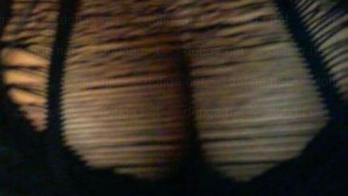 li se spune reginele siliconului cum arata fetele care nu mai au nicio expresie faciala din cauza