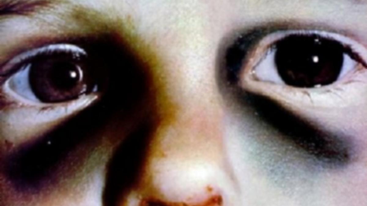 caz dramatic la vaslui o fetita de patru ani infometata si lovita adusa in coma la spital chiar de