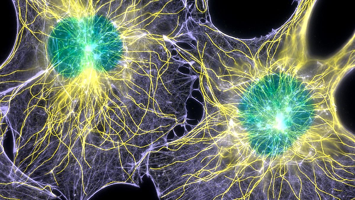 studiu vaccin impotriva cancerului eficient in ultimele stadii ale bolii